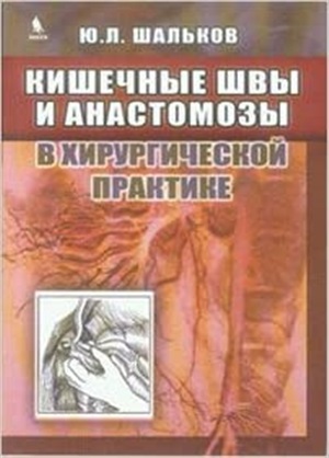 Кишечные швы и анастомозы в хирургической практике