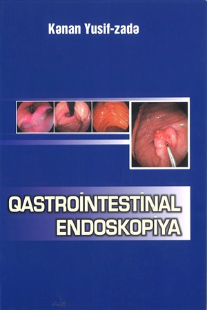 Qastrointestinal endoskopiya